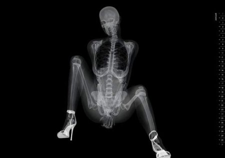Эротический рентген